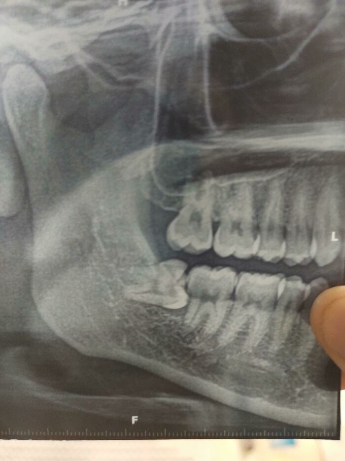 Say Hello To My Little Friend