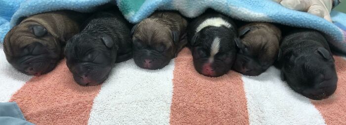 My First C-Section Was Successful