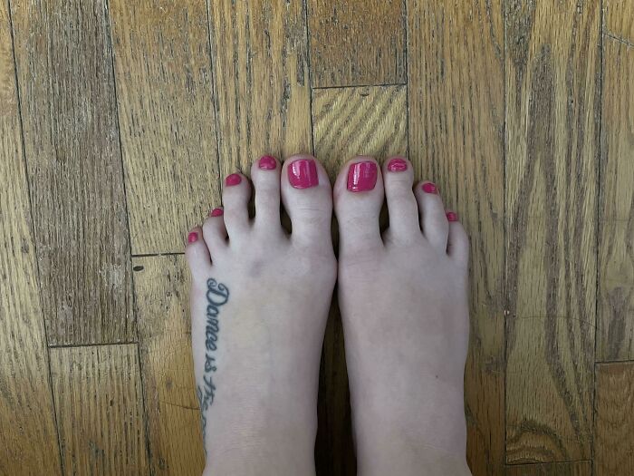 I Was Born With 4 Toes On One Foot