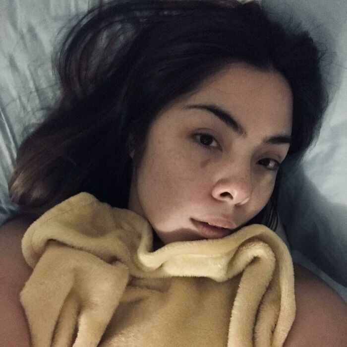 I Have A Tear Drop Shaped Birthmark Perfectly Placed Under My Right Eye