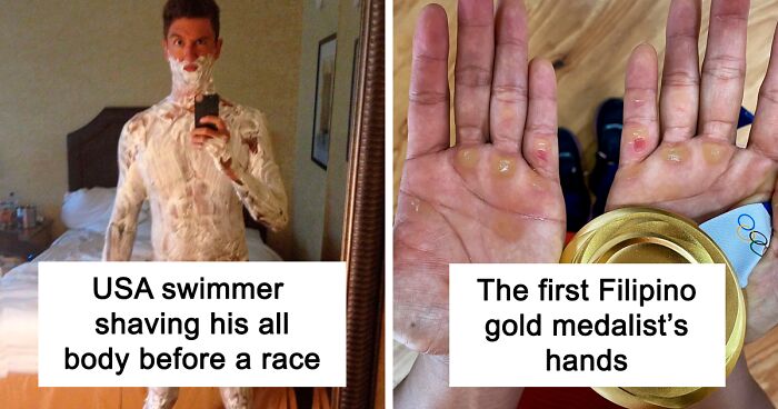 50 Freaky Photos Of Olympians And Other Athletes To Give You A New Perspective On The Human Body