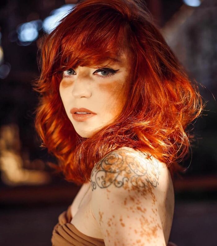 Woman With Vitiligo Overcomes Her Self-Confidence Issues After A Photoshoot With Famous Makeup Artist