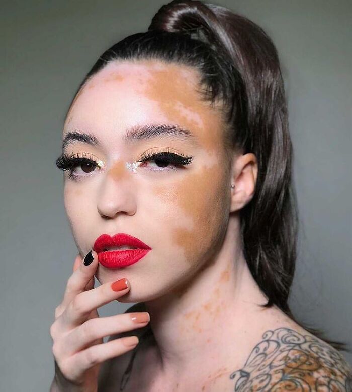 Woman With Vitiligo Overcomes Her Self-Confidence Issues After A Photoshoot With Famous Makeup Artist