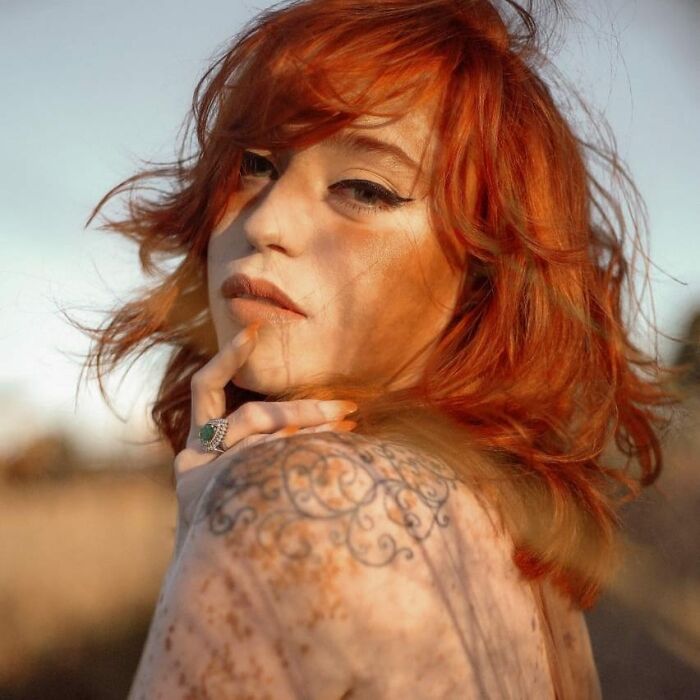 Woman With Vitiligo Overcomes Her Self-Confidence Issues After A Photoshoot With Famous Makeup Artist