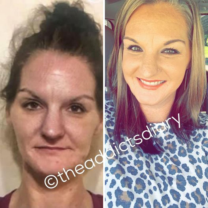 Drug-Addiction-Before-After-Transformation-Photos