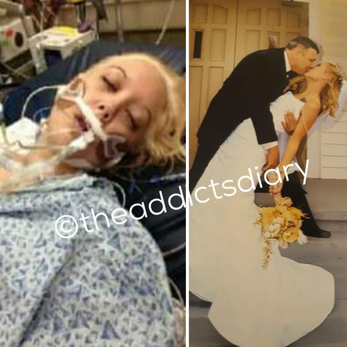 Drug-Addiction-Before-After-Transformation-Photos