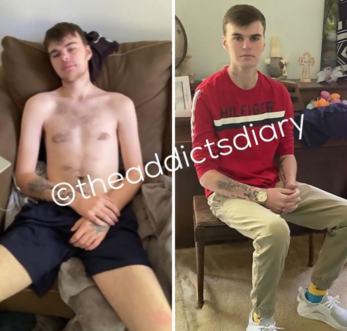 Drug-Addiction-Before-After-Transformation-Photos