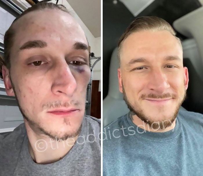 Drug-Addiction-Before-After-Transformation-Photos
