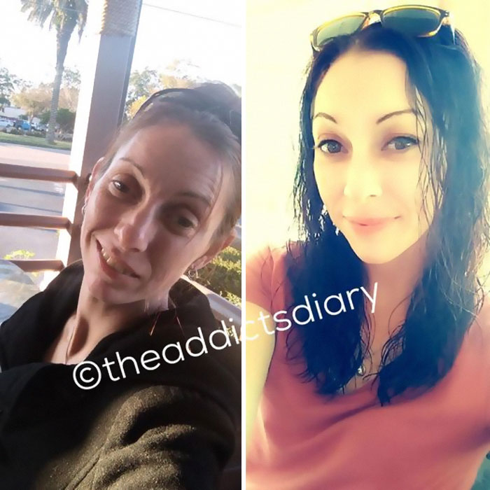 Drug-Addiction-Before-After-Transformation-Photos