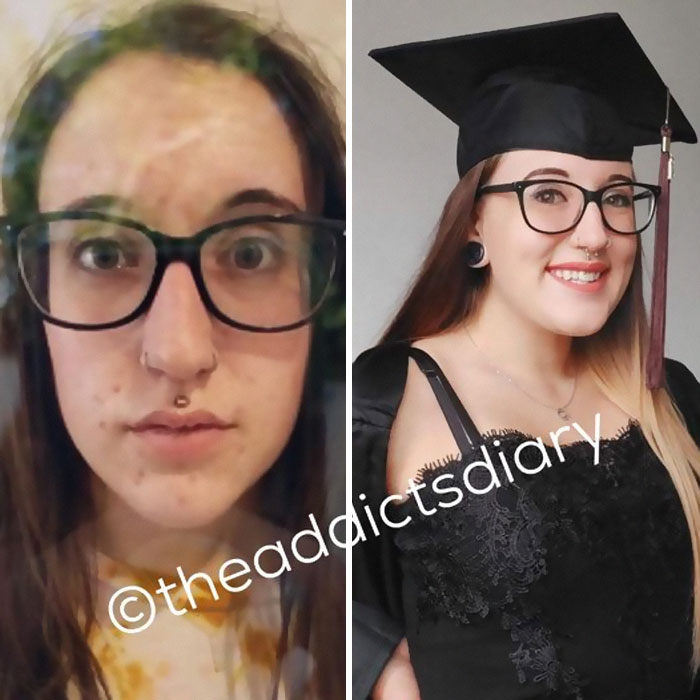 Drug-Addiction-Before-After-Transformation-Photos