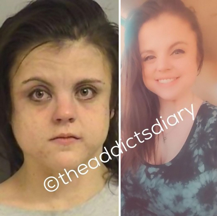 Drug-Addiction-Before-After-Transformation-Photos