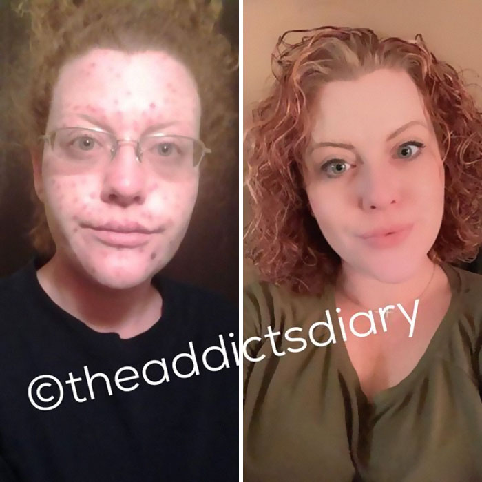 Drug-Addiction-Before-After-Transformation-Photos