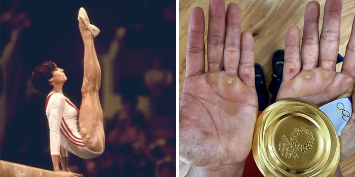40 Fotos extrañas de atletas olímpicos y otros deportistas que te darán una nueva perspectiva del cuerpo humano