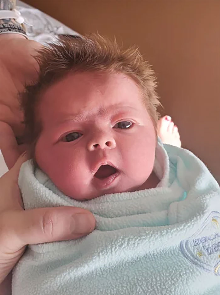 Our Baby Came Out With Some Hair