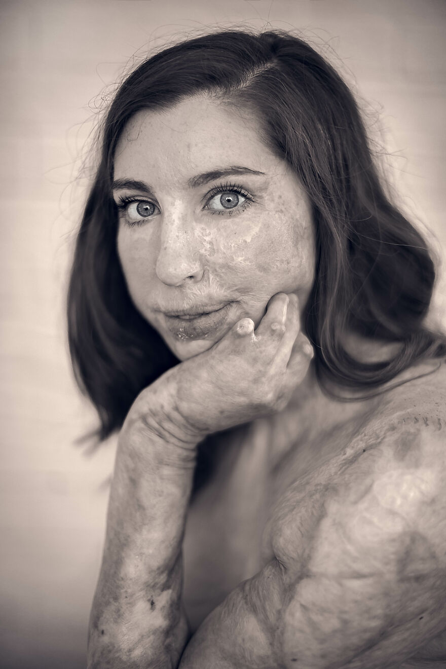 My 8-Year-Old Daughter Asked Me If She Was Beautiful, So I Decided To Do This Photo Project My 8-Year-Old Daughter Asked Me If She Was Beautiful, So I Decided To Do This Photo Project