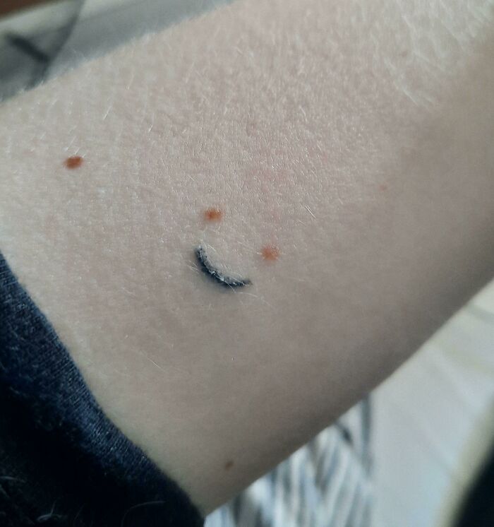 Lil Smiley Tattoo I've Made Out Of Birthmarks 2 Days Ago