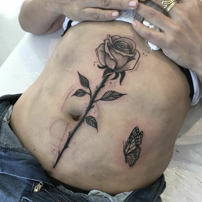 Coverage Of Scars That Happened On Luciene, Thank You For Your Trust