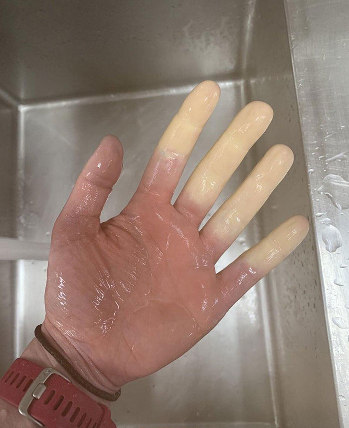 Skin Texture Failed To Load