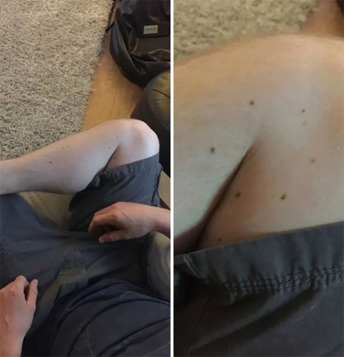 My Brother Has A Perfect Hexagon Of Moles When Sitting Like This