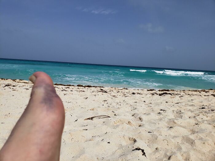 Broke My Foot In Cancun, First Day Of My Honeymoon