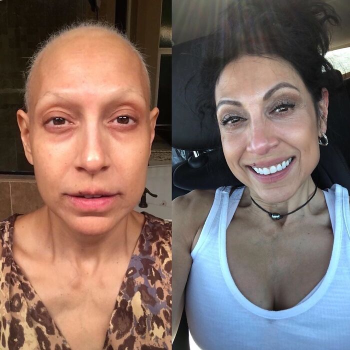 During Her Battle With Cancer And After She Beat It