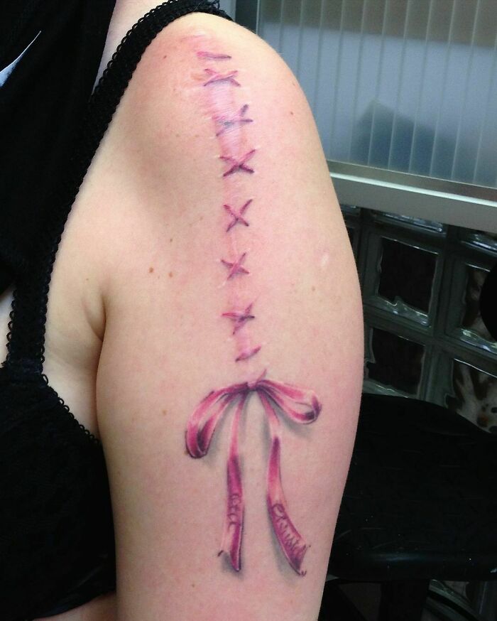 Tattoo cover-up on arm transforming scar into a creative design with stitches and ribbon.