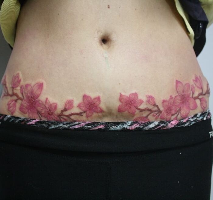 Delicate Work On The Scar, Very Happy With The Result, Thanks To Sandra For Trusting Me With This