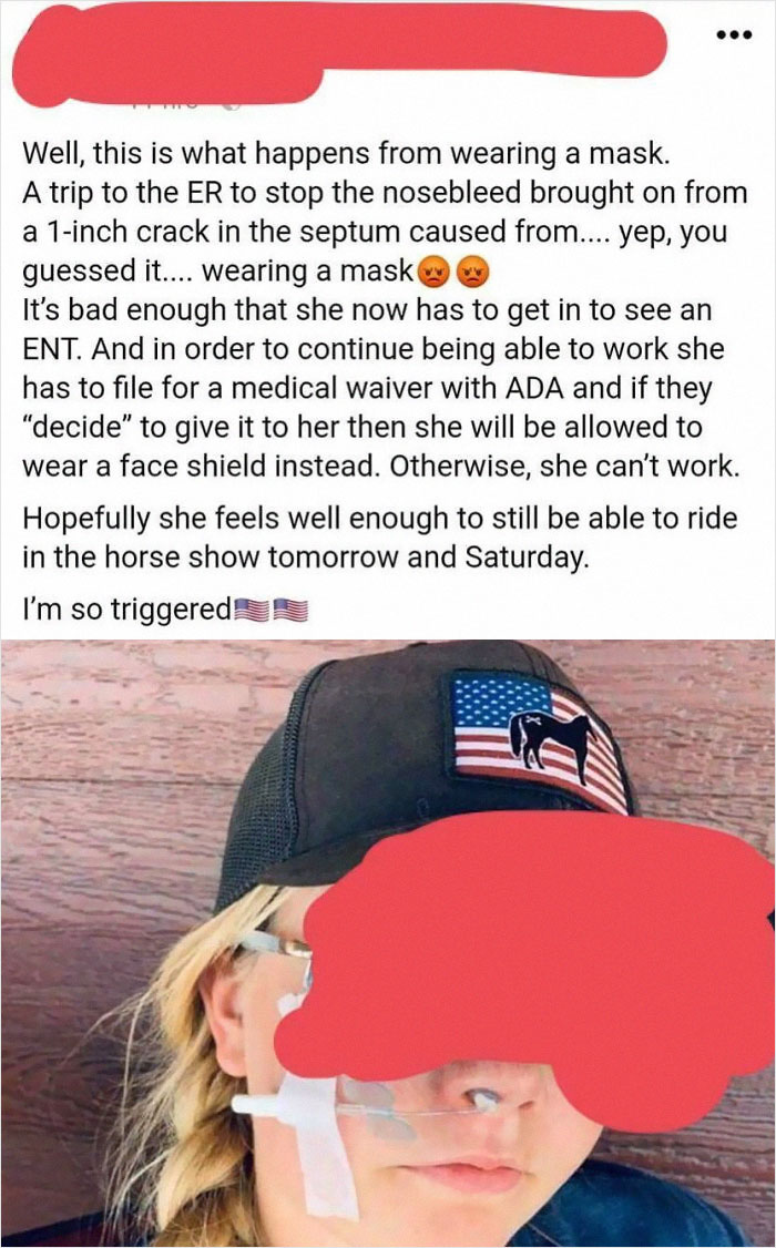 Wearing A Mask Gave My Daughter A 1 Inch Crack In Her Septum