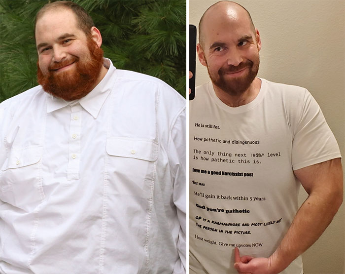 Publico mis fotos de pérdida de peso para motivar a otros