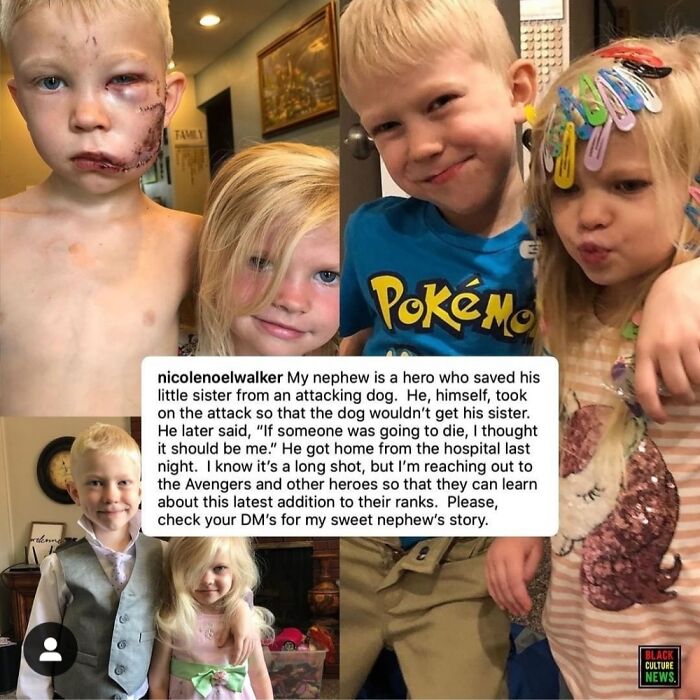 Heroic 6 Year Old Boy Saves Sister (4) From Dog Attack, What A Legend!