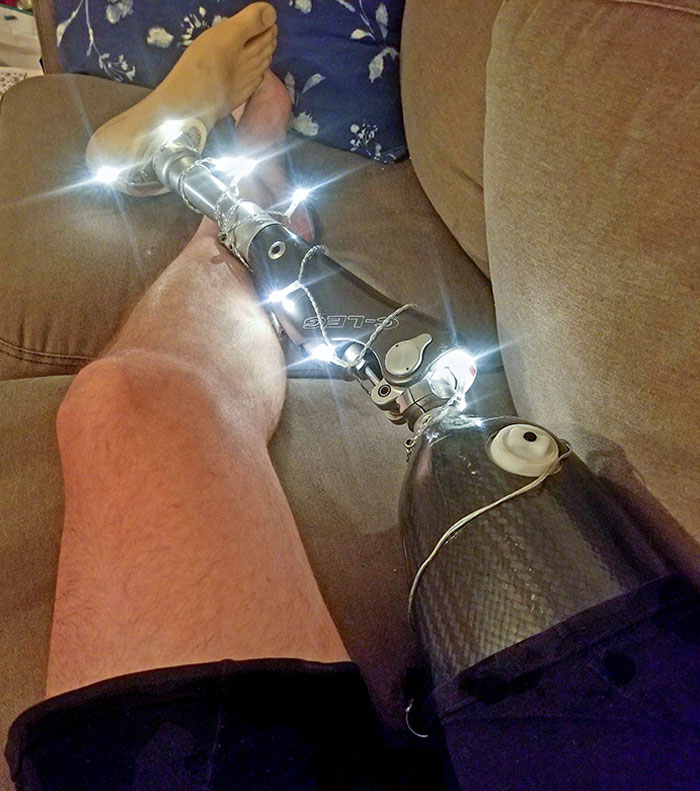 Mi hermana pensó que a mi pierna le vendría bien más espíritu navideño