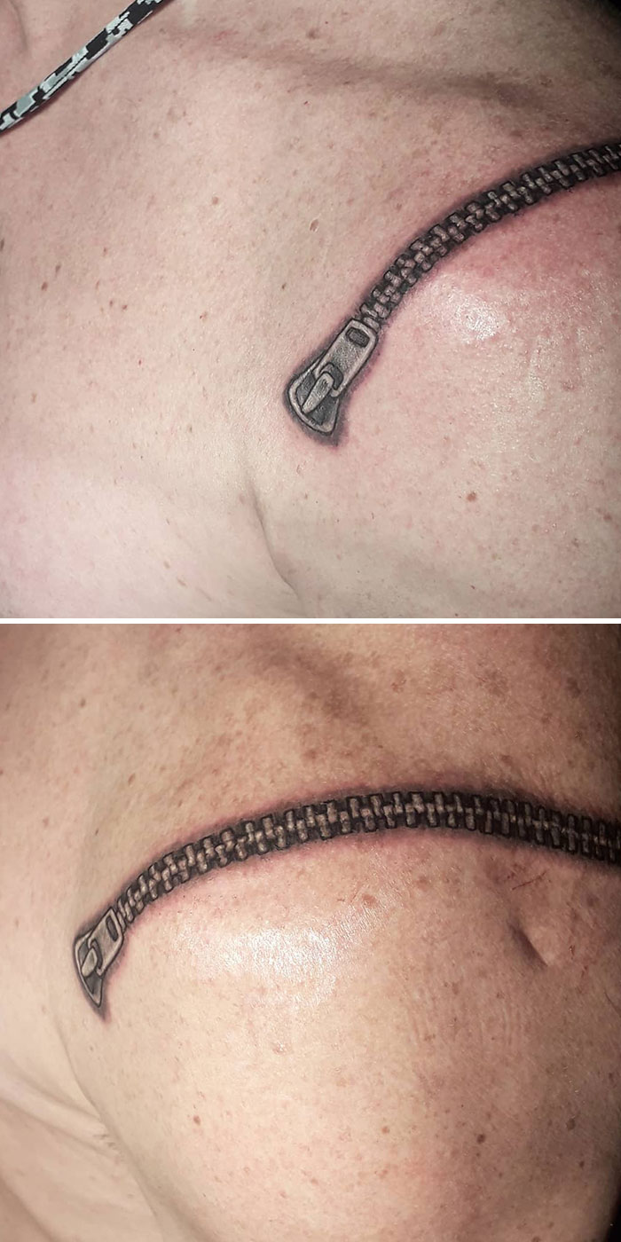What To Do With A Mean-Looking Shoulder Scar? Zip It Up, Zip It Up