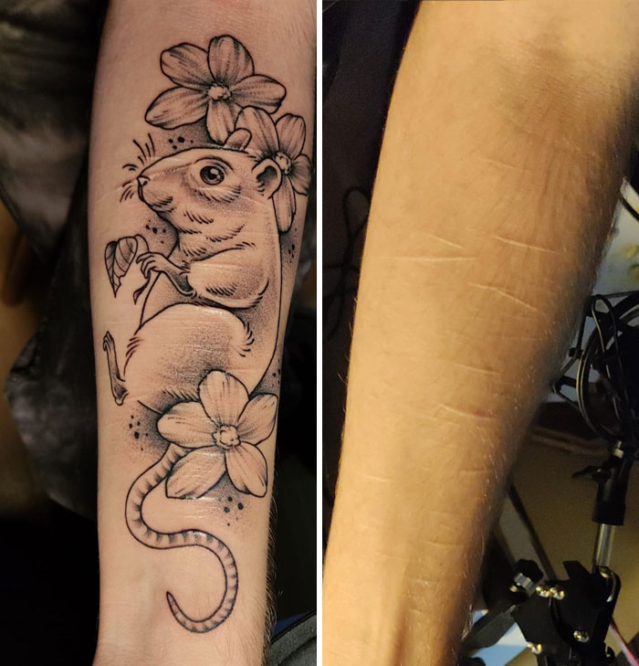 After 6 Years, Many Laser Scar Removal Treatments, Scar Strips And So, I Decided To Get A Tattoo Over My Scars And Loving The Result
