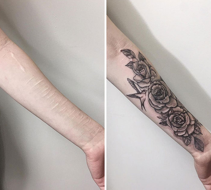 Flowers Covering Scars