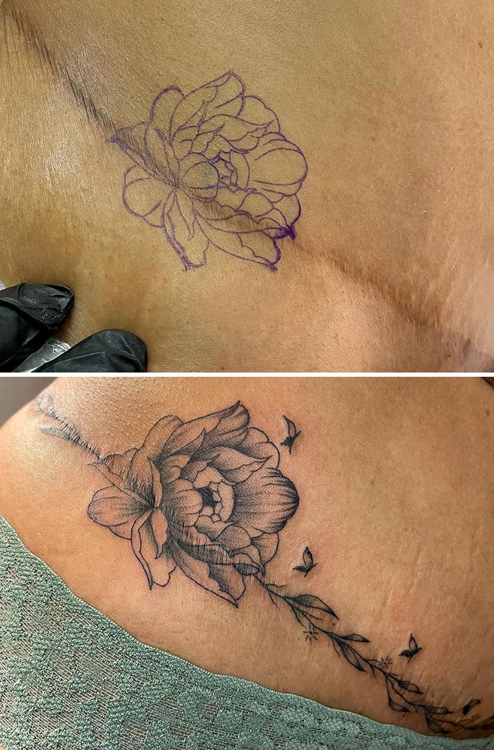 There Are Two Marks On Our Skin That Are Forever: Scars And Tattoos