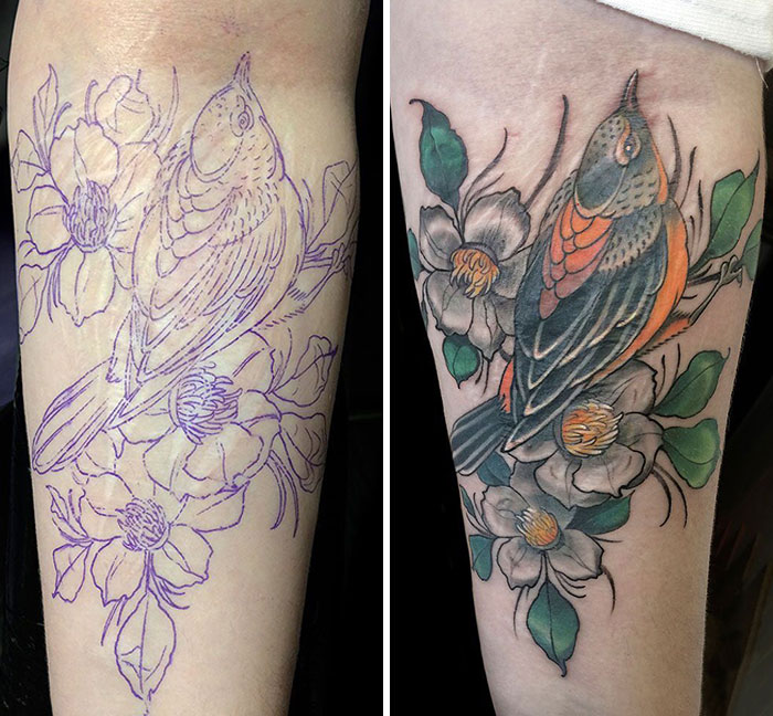 There Are Times When A Tattoo Can Serve A Useful Function. For Example, Covering Scars. This Is Especially True For Those With Large Scars That Create Aesthetic Discomfort For The Wearer