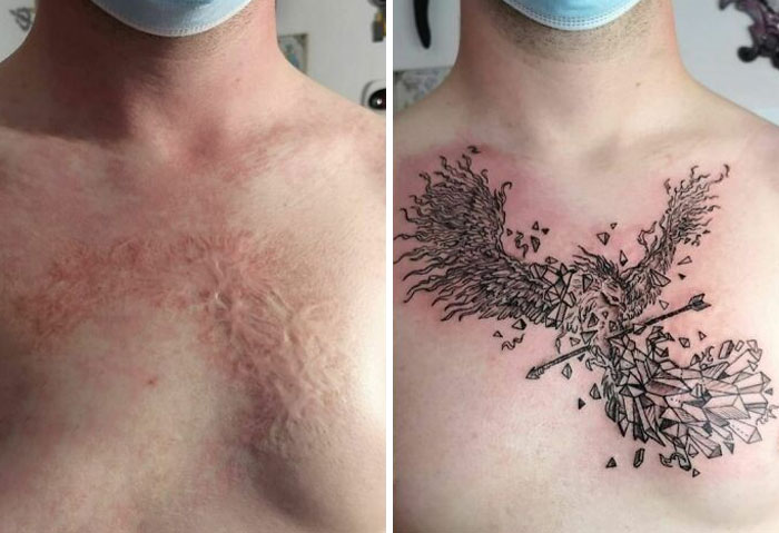 50 Times People Asked Tattoo Artists To Cover Up Their Scars And Birthmarks  And Couldn't Be Happier With The Result | Bored Panda