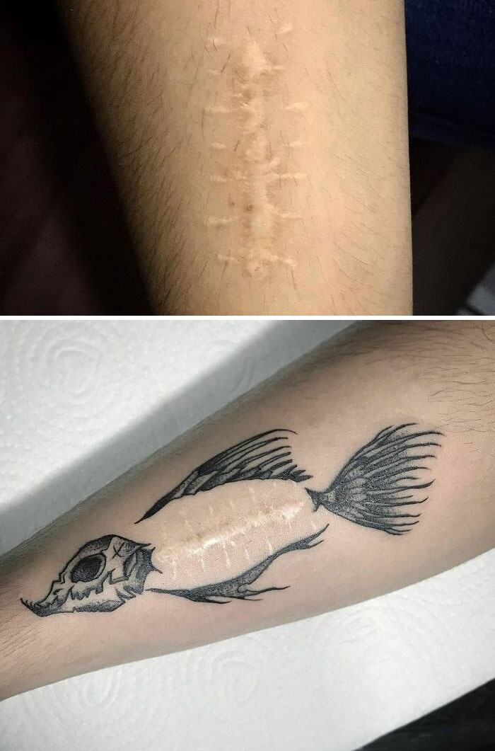 Convirtiendo una cicatriz en la columna de un pescado