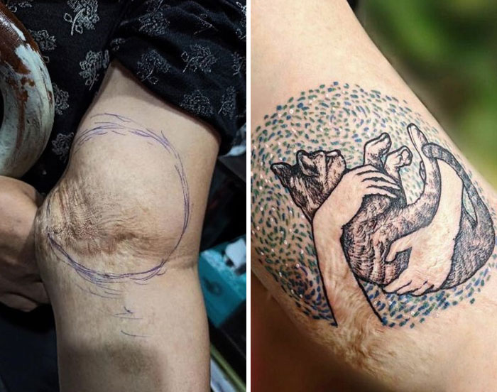 Las cicatrices son tatuajes con mejores historias