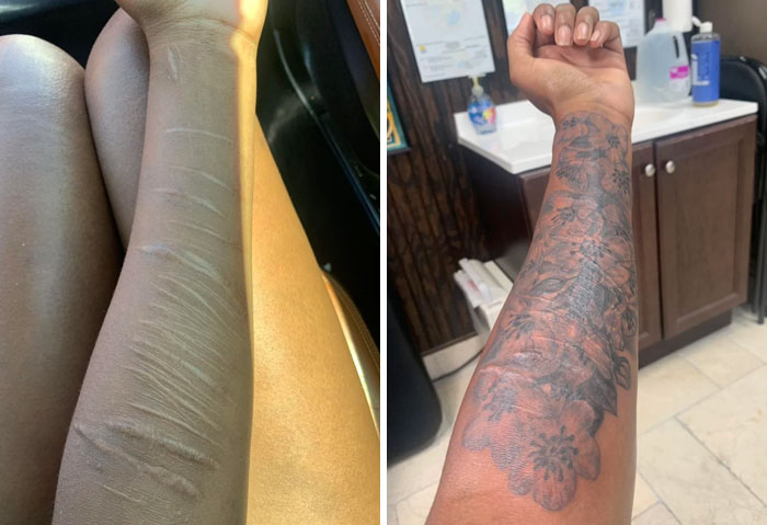 Tattoo cover-up of scars on forearm, featuring floral design, showcasing transformation and artistry.