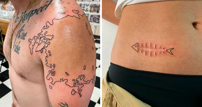 50 Times People Asked Tattoo Artists To Cover Up Their Scars And Birthmarks And Couldn’t Be Happier With The Result