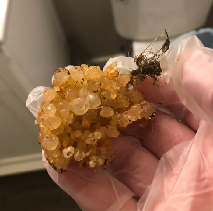 Our Shower Was Continuously Becoming Clogged And Would Create Standing Water. The Plumber Pulled This Out Of The Shower Pipe. It’s Hard, But A Little Soft, Almost Like Hardened Sap. It’s Light Yellow To Dark Gold. No Odor. Smooth On Sides And Bubbly On Top