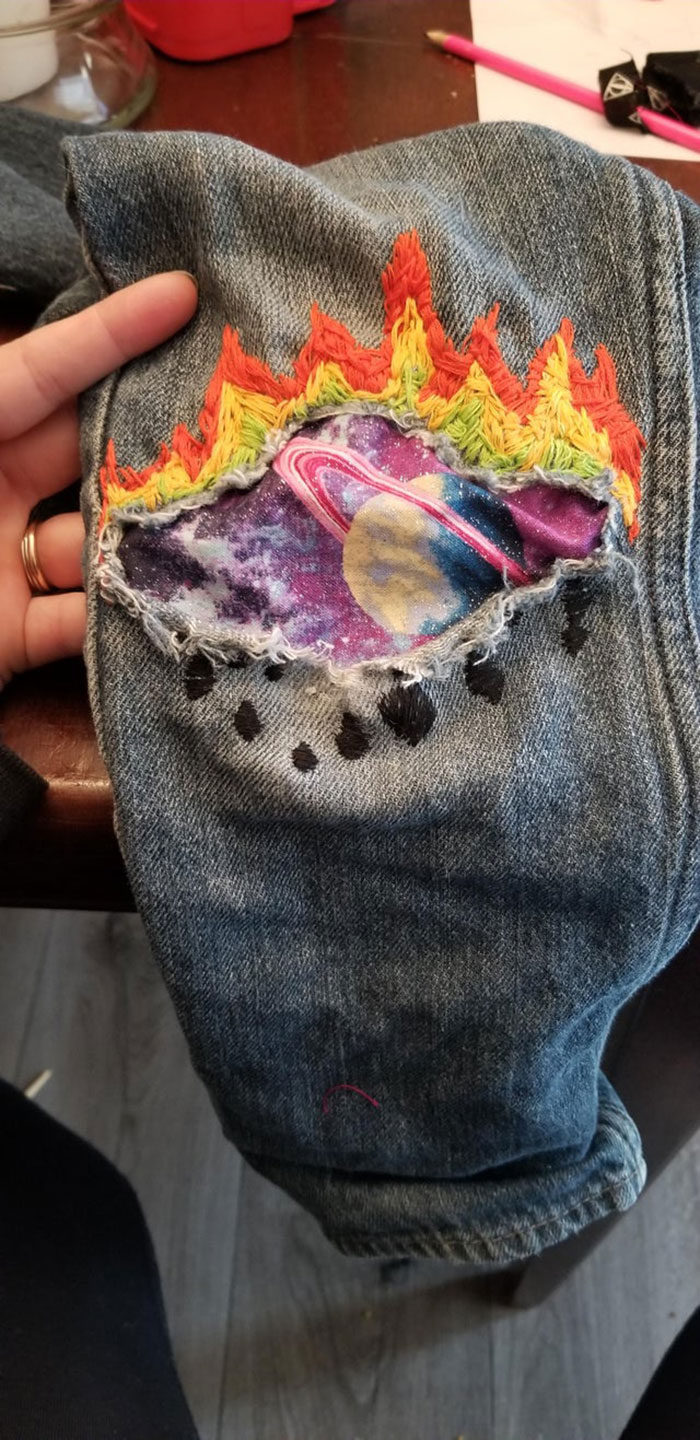 My Child Requested "Flames In Space" For His Knee Mend..