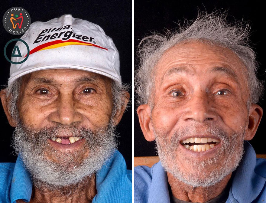 Brazilian Dentist Travels The World To Recover Smiles From People In Needy Communities (32 New Pics)