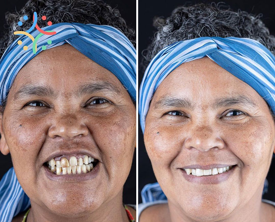 Brazilian Dentist Travels The World To Recover Smiles From People In Needy Communities (32 New Pics)