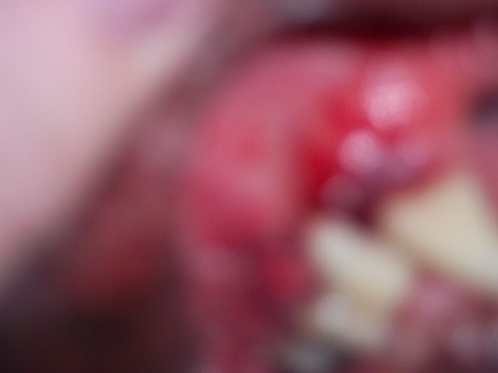 Have No Idea, I Think It Is A Picture Of A Wound On One Of My Dogs' Gums.