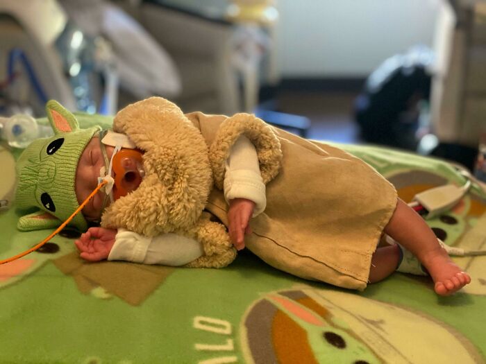 Nuestro hijo nació con 25 semanas hace casi 2 meses. Su enfermera le hizo este épico disfraz