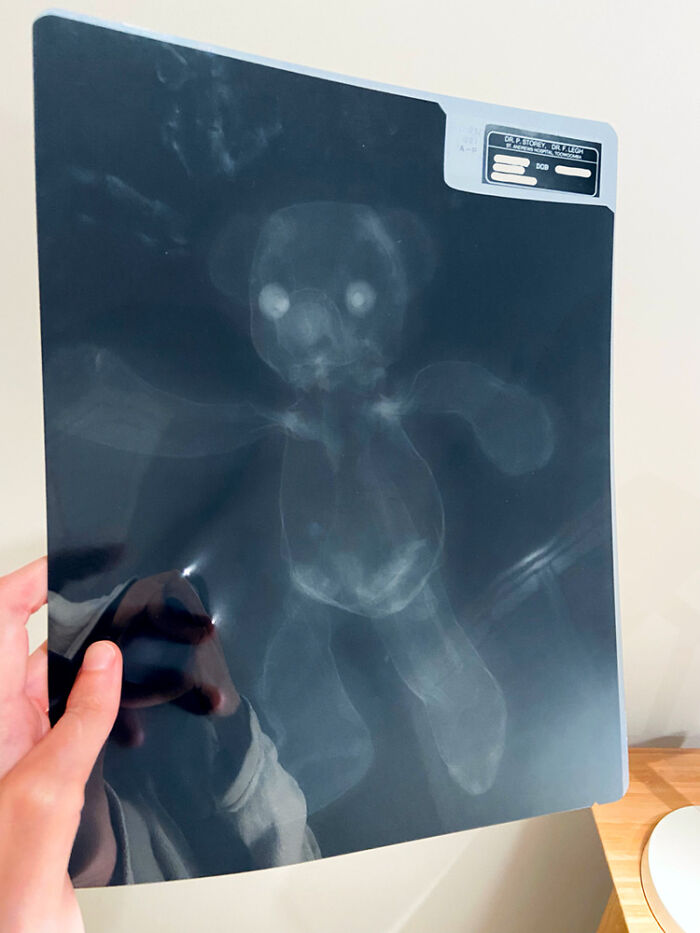 X-Ray Of My Childhood Bear, Taken In The 90s