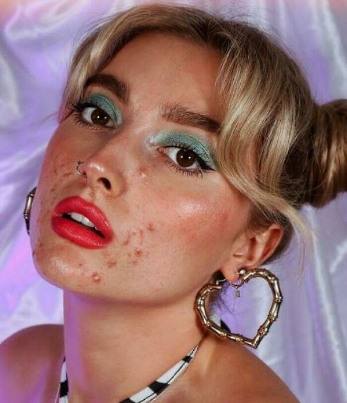 Makeup Company Uses Model With Real-Life Skin