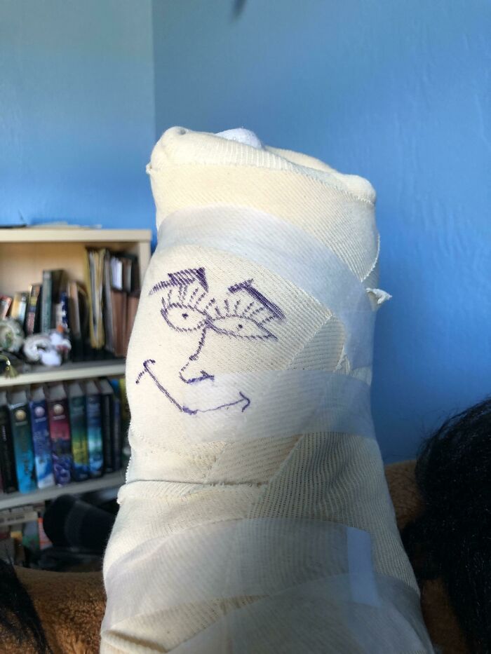 My Doctor Drew A Smiley Face On My Foot Bandages After Surgery